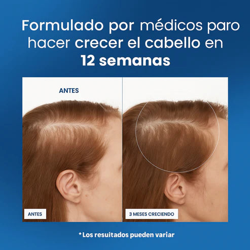 Roll-On Crecimiento Capilar™