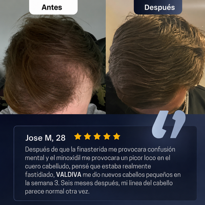 Roll-On Crecimiento Capilar™