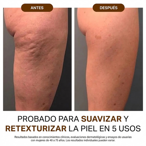 Anti-Cellulite® | Aceite de Masaje Natural (100ml)