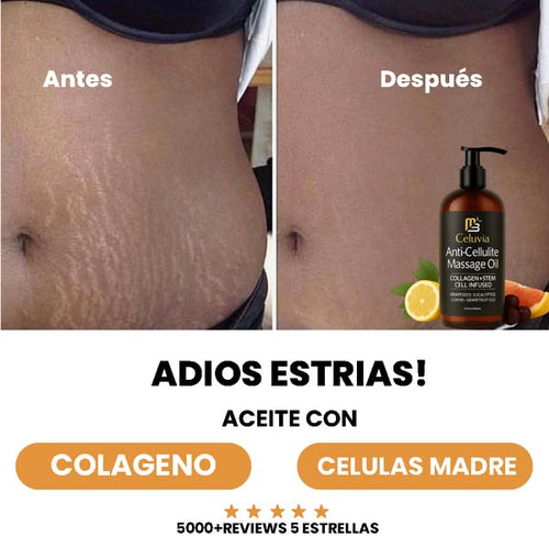 Anti-Cellulite® | Aceite de Masaje Natural MX (100ml)